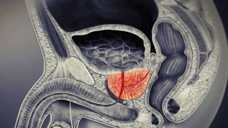 1763530966594_1759300534491_Prostate_Red_