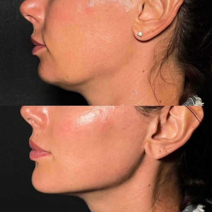 Senza titolo (720 x 720 px)